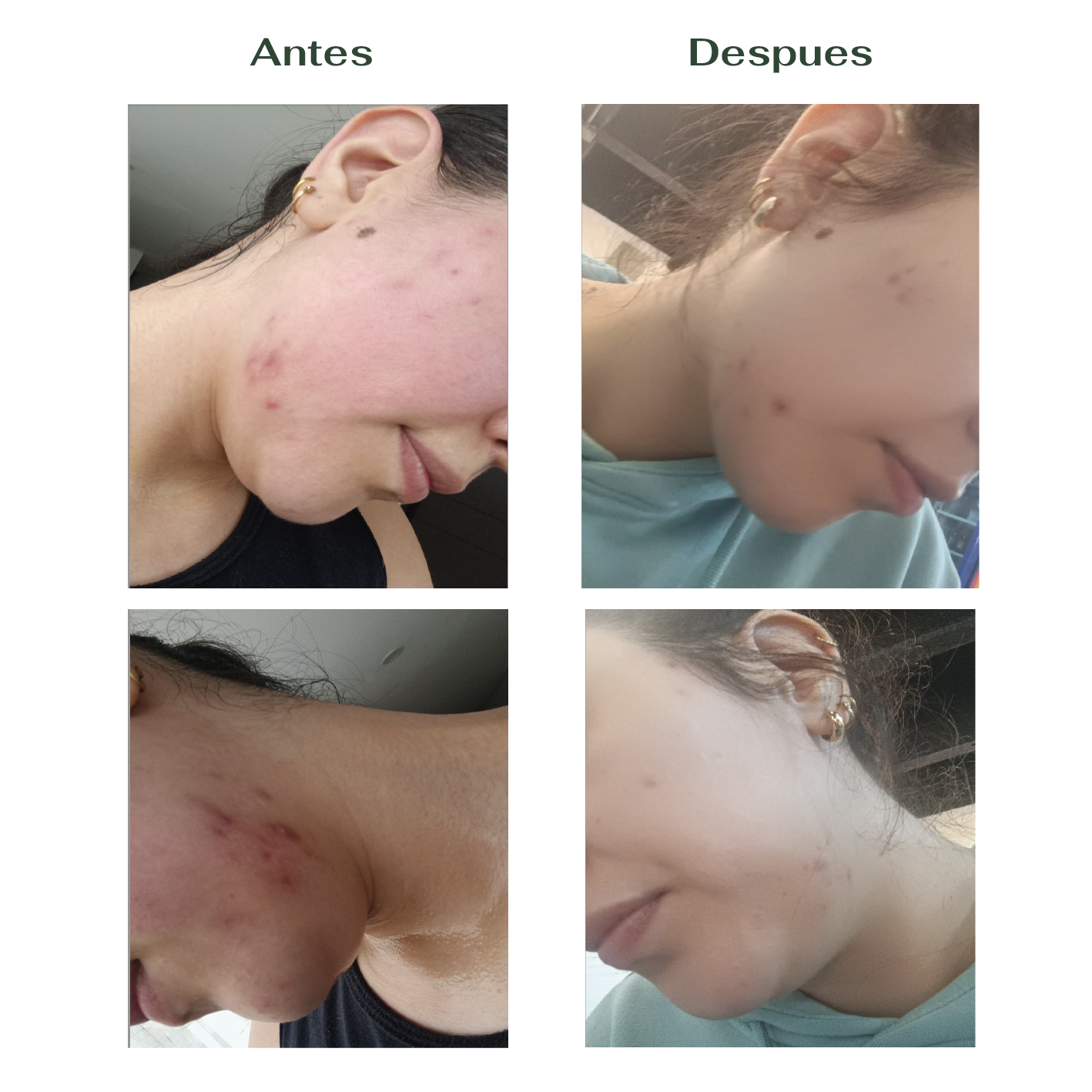 Serum Reparador Nocturno - Árbol de Té (Bio-Retinol) 20mL